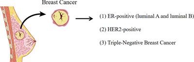 Targeting metabolism of breast cancer and its implications in T cell immunotherapy